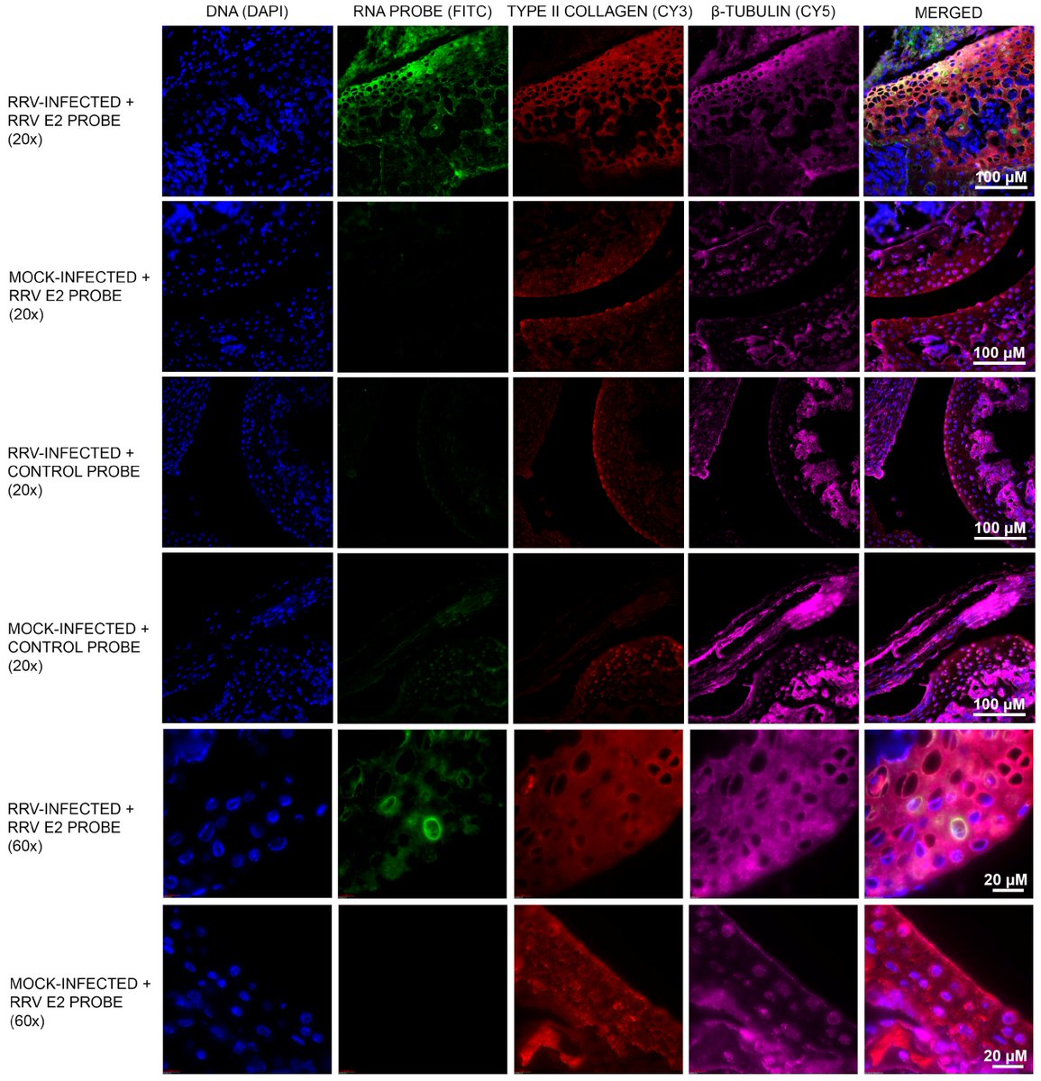 VirusesMDPI's tweet photo. Communication #Chondrocytes Contribute to #Alphaviral Disease #Pathogenesis as a Source of #VirusReplication and Soluble Factor Production by Lara J. Herrero @lara_marcus and colleagues
(@Griffith_Uni ), read it here: https://t.co/DJFc8HBENq https://t.co/1w8OCPSrUV