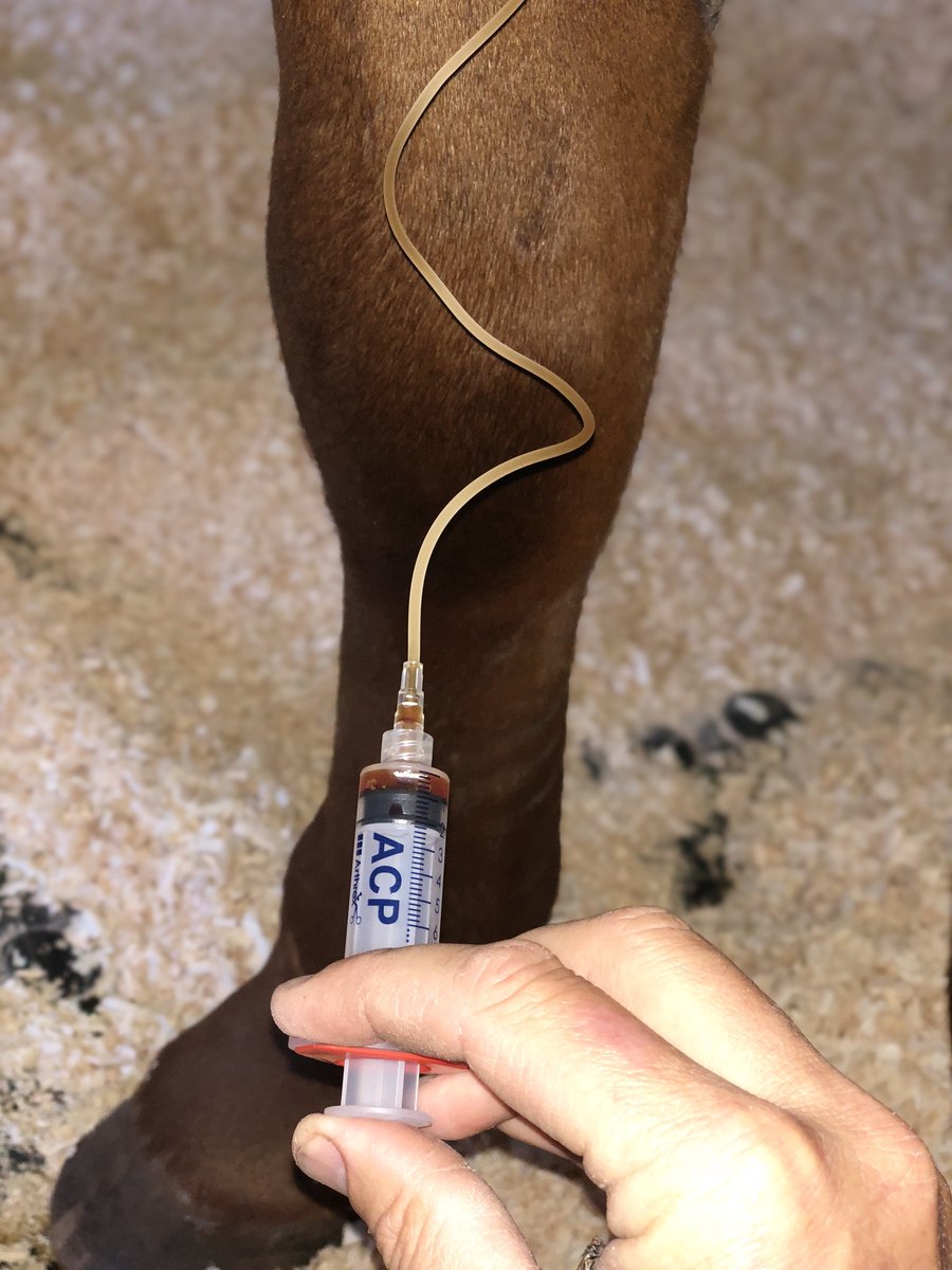WinelandsEquine's tweet photo. Stem cells and other bioactive factors delivered precisely into damaged tissue for superior tissue healing #Horse #HorseHealth #GetTheFacts #GetADiagnosis #MobileImaging #Arthrex #ArthrexVetSystems #PRP #InternistOnTheRun #StemCellTherapy #VeterinarySpecialist #LoveCapeTown https://t.co/A4WCctzdat