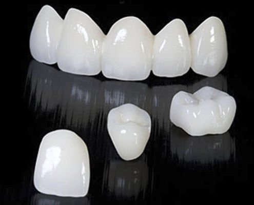 l' #utilisation du #Zirconia en #CFAO Direct : #webinar sur connectdentalcampus.fr  👉👉 fr.dental-tribune.com/news/webinaire…