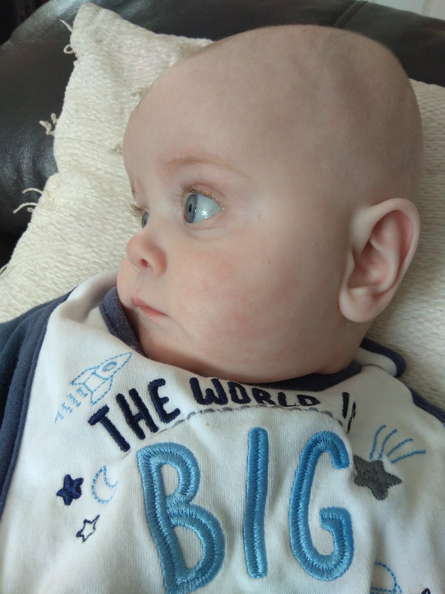 rachcross78's tweet photo. @loosewomen my 5 month old boy twin is fascinated with Catrin Pugh's story. An amazing young lady! Xx https://t.co/lJlc8faGiz