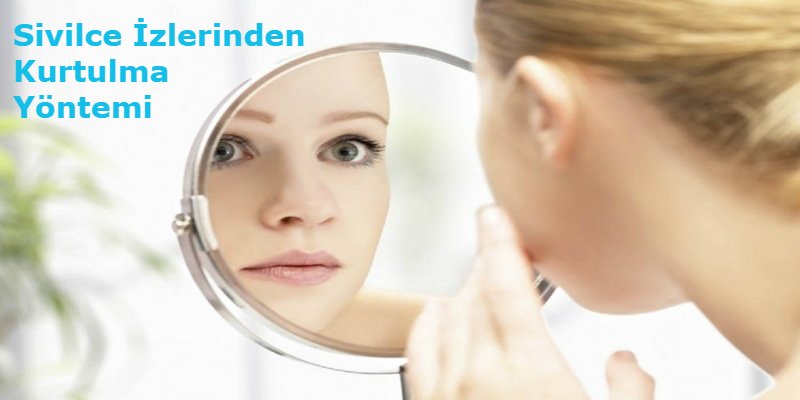 Sivilce İzlerinden Kurtulma Yöntemi
 #dermatolog #fulyatezel #sivilceizleri #kurtulmayöntemleri #tedavi #kimyasalpeeling #karbonpeeling #tavsiyeler #alanyapower goo.gl/RkAiZ8