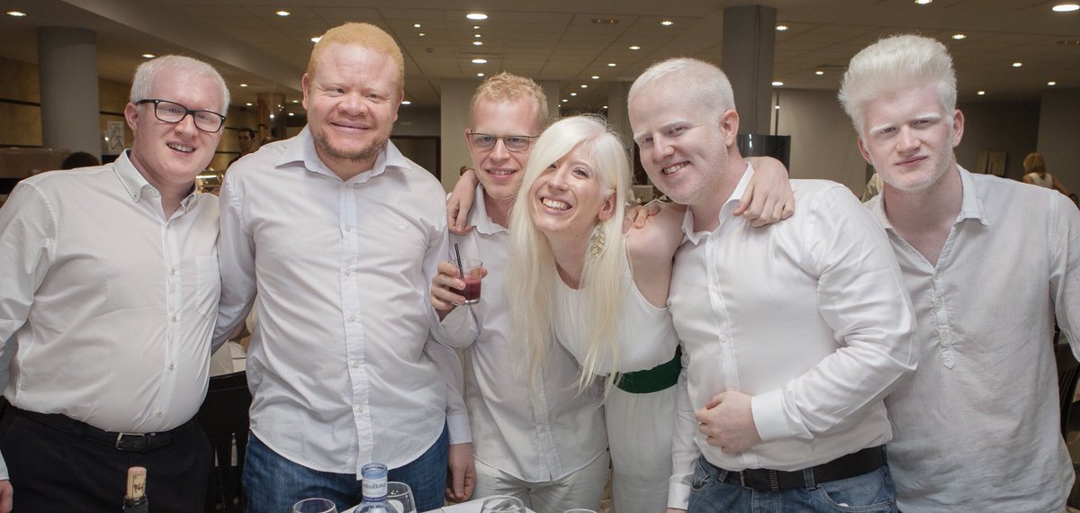 LluisMontoliu's tweet photo. La semana próxima nos vamos a Noruega a hablar de #albinismo como científicos, como jóvenes, como personas con @ALBA_albinismo Estaremos @vieroymony @PattyBonet @epuig @javi__andres @TxellPFaus y más amigos https://t.co/rLLZUe8GVsª-jornadas-europea-sobre-albinismo-4eda.html https://t.co/TRJ4cjVjpp