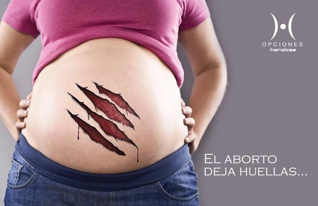 AlannLattar's tweet photo. El aborto va en contra del mandamiento del amor.
#NoAlAborto #SiAlaVida https://t.co/J0hkp99VoD
