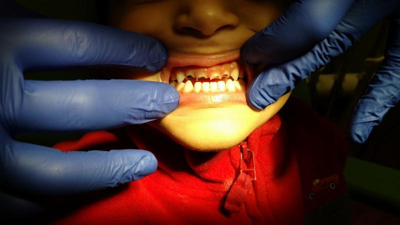 KinderSmile_'s tweet image. What's new at KinderSmile Foundation? Read our latest newsletter: bit.ly/ToothTalk-Marc… #ToothTalk