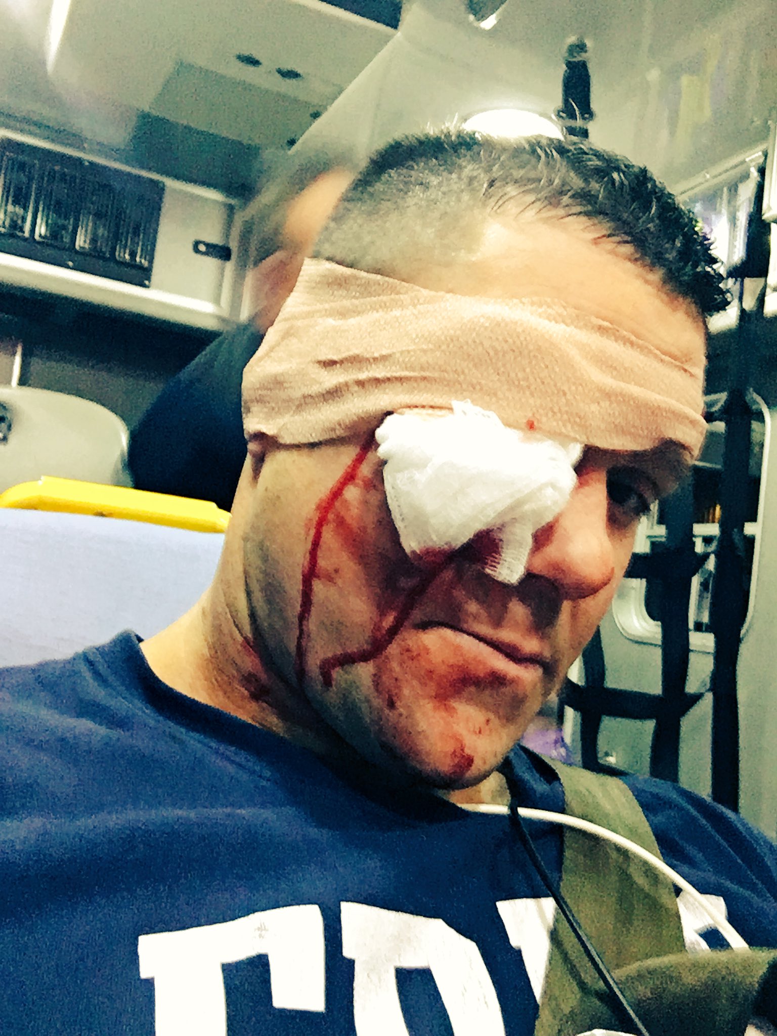 Edward on Twitter: "Some Aftermath of a baseball bat to the #PirateLife #Arrrrrrrrrrrrrrrrrrr https://t.co/gvyZYv1YtL" /