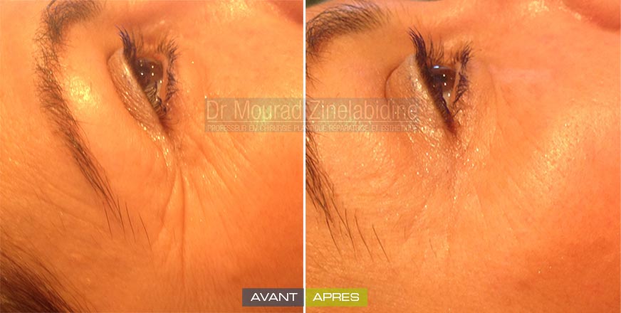 softesthetique's tweet photo. #MÉDECINE #ESTHÉTIQUE
#INJECTION #BOTOX #TUNISIE
par #Dr_Mourad_Zinelabidine
https://t.co/DjYlr6LZch https://t.co/QIKbvg9bLD