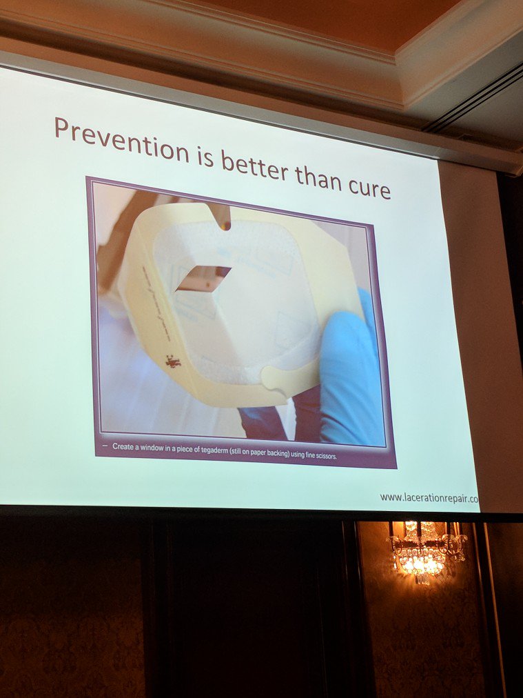 MandieV83's tweet photo. Practice changing! Use tegaderm to avoid getting glue where you didn't want it.. thanks Preeti! #MPANZ18 #paedsED #FOAMED https://t.co/Q758FY0vwv
