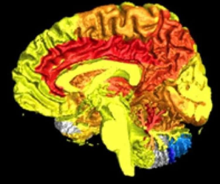 wef's tweet photo. Women have more active brains than men, according to science https://t.co/6oHUy2CSuW #mentalhealth https://t.co/065eOL3fkb