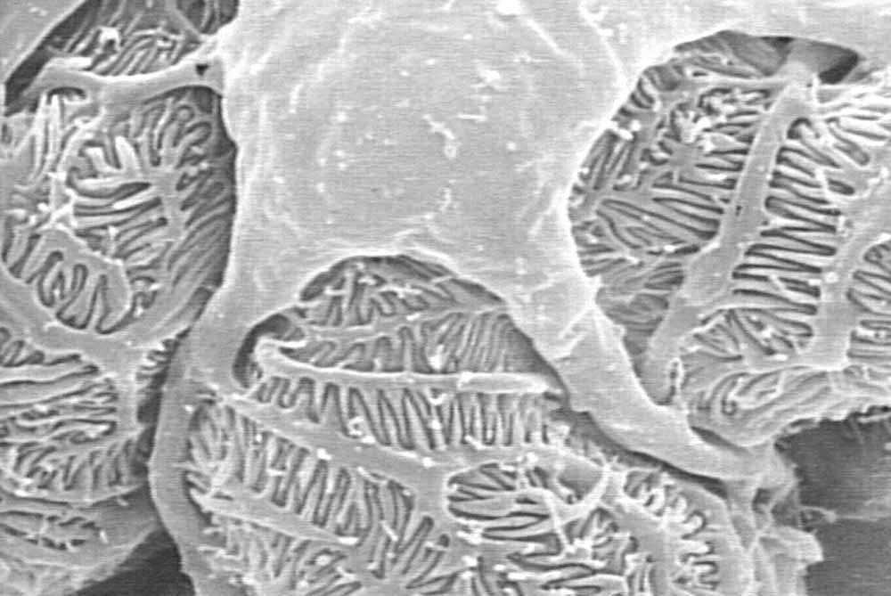Journal_AJCPR's tweet photo. NEPHROPATHOLOGY https://t.co/dr9RRXam2w
#Article #Submissions #open for #Clinical #Pathology #Research https://t.co/OvTFsqJAYr
