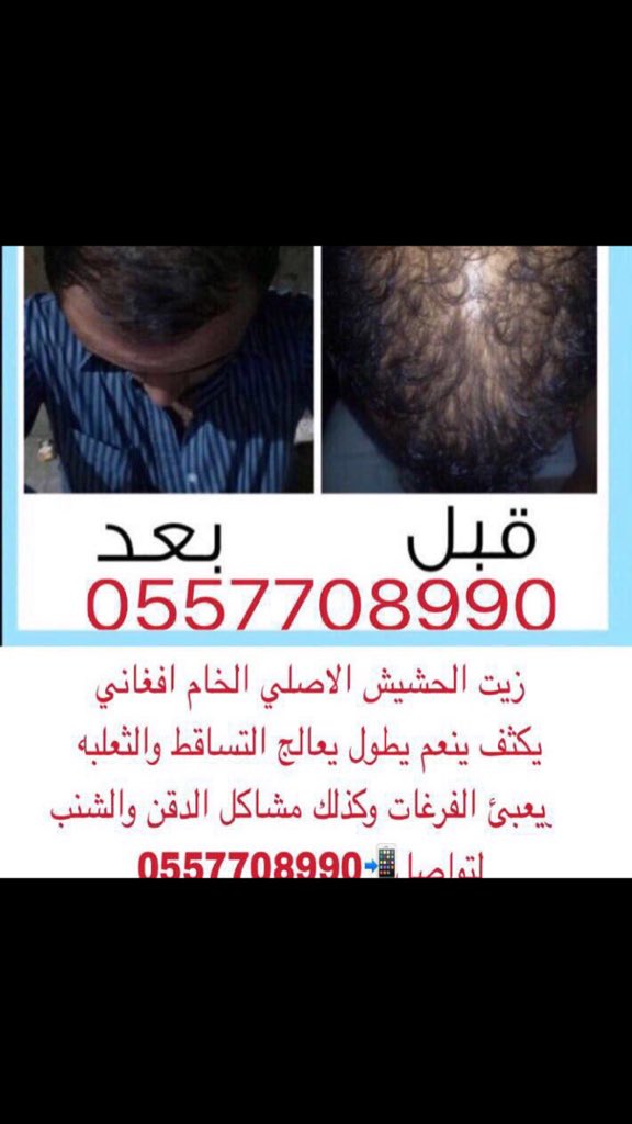 sh05521's tweet photo. زيت حشيش افغاني 
ممتاز في تطويل الشعروينبت الفراغات يعالج الثعلبه يكثف يوقف التساقط وينبت الدقن والشنب  مجرب ومفعوله قوي 
0557708990 https://t.co/VmT1saZK56