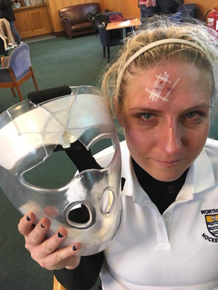 This happened to a <a href="/WorthingHC/">Worthing Hockey Club</a> player yesterday and needs to be shared. Face masks save lives.