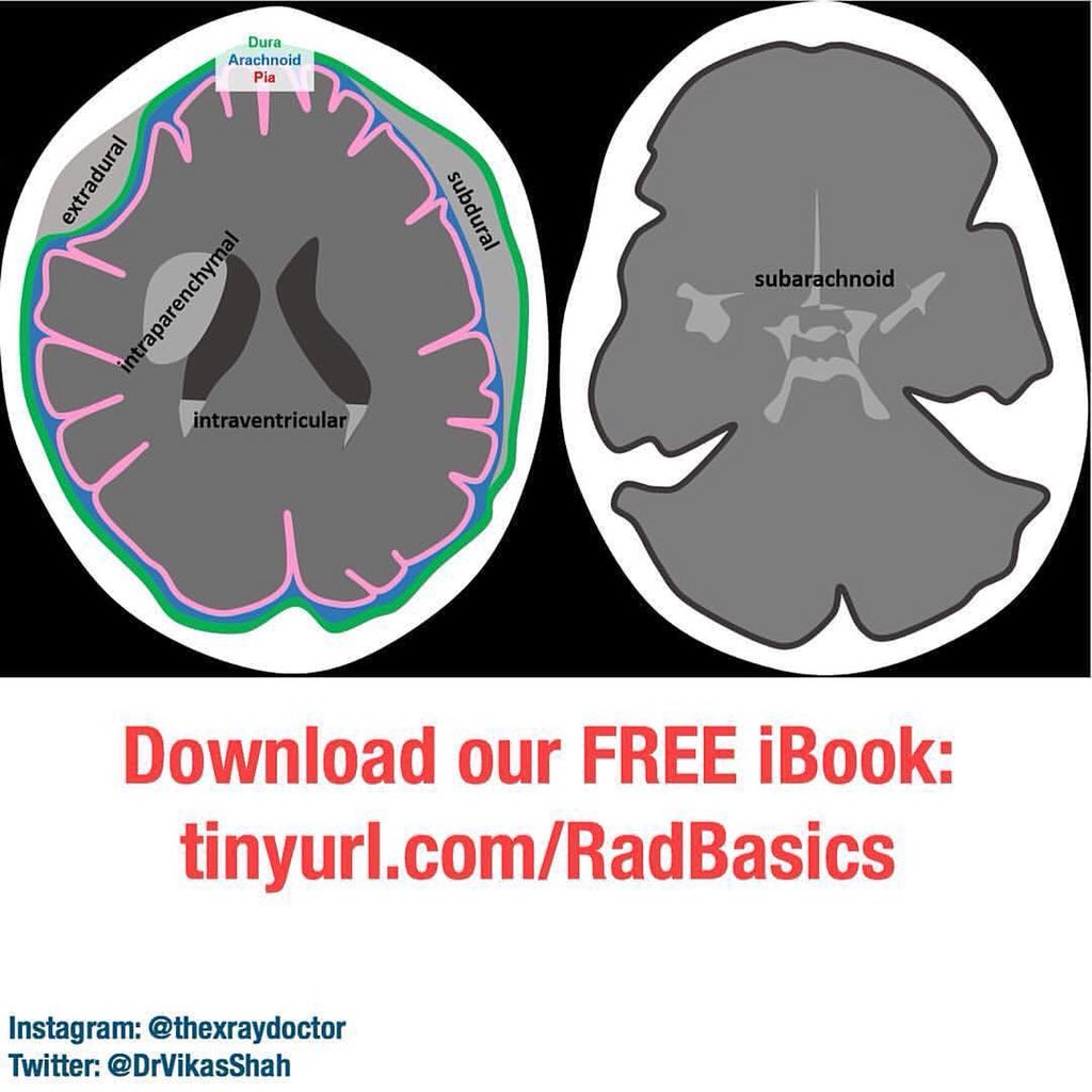 download the official patients sourcebook on gastritis a revised and updated directory for the