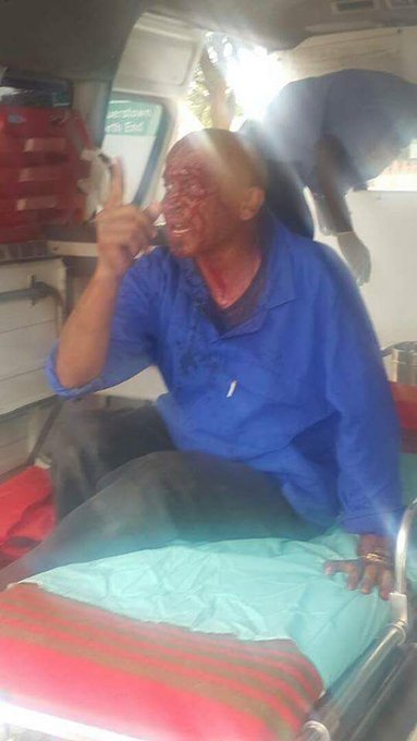 povonewstv's tweet photo. Victims of MDC-T violence in Bulawayo earlier today 

#MDCZimbabwe #MDCT #Bulawayo #WitnessDube #ThokozaniKhupe #NelsonChamisa #Zimbabwe https://t.co/6uinXhIysY