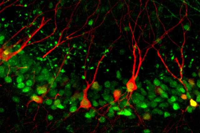 MIT's tweet photo. Neuroscientists discover a cellular pathway that encodes memories by strengthening specific synapses. https://t.co/tZ2CFnT5nU https://t.co/kauUCJy3T2