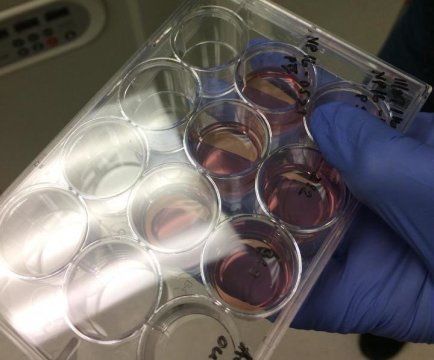 cynymeyer's tweet photo. Stem-cell study points to new approach to Alzheimer's disease https://t.co/Pn2OJjiVcW https://t.co/Wx8iiMBcjK