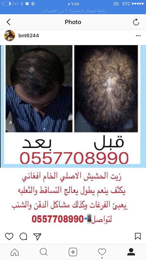 sh05521's tweet photo. زيت الحشيش الاصلي الخام ينبت الدقن والشنب ويكثفه يعالج التساقط ينعم يطول الشعر يمنع التساقط ويكثف الشعر الشحن مجاني لفترة محدودة👌🏻0557708990 https://t.co/8vAoUYIrvM