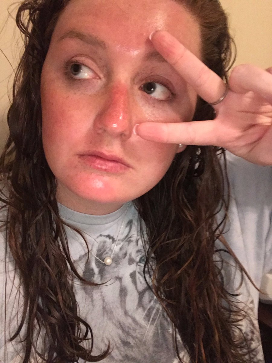 sasssyburrito's tweet photo. The best way to spread St. Patrick’s Day cheer is a combination of aloe & lavender for ur intense sunburns #firstburnoftheyear https://t.co/92sHSTTsPu