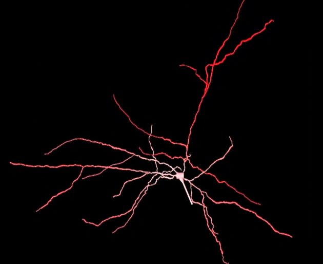 AllenPhil_'s tweet photo. In our universe: The @AllenInstitute  is sharing a huge database of computerized neurons at work. 

Why this is an important landmark: https://t.co/Ohxy26Fhyu https://t.co/f7tqJ2G2LC