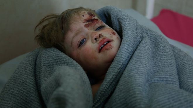 IAmUzaair's tweet photo. My tears have long dried but my face cries save me #Ghouta #letsUniteToSaveSyria https://t.co/MUUgzAQrhB