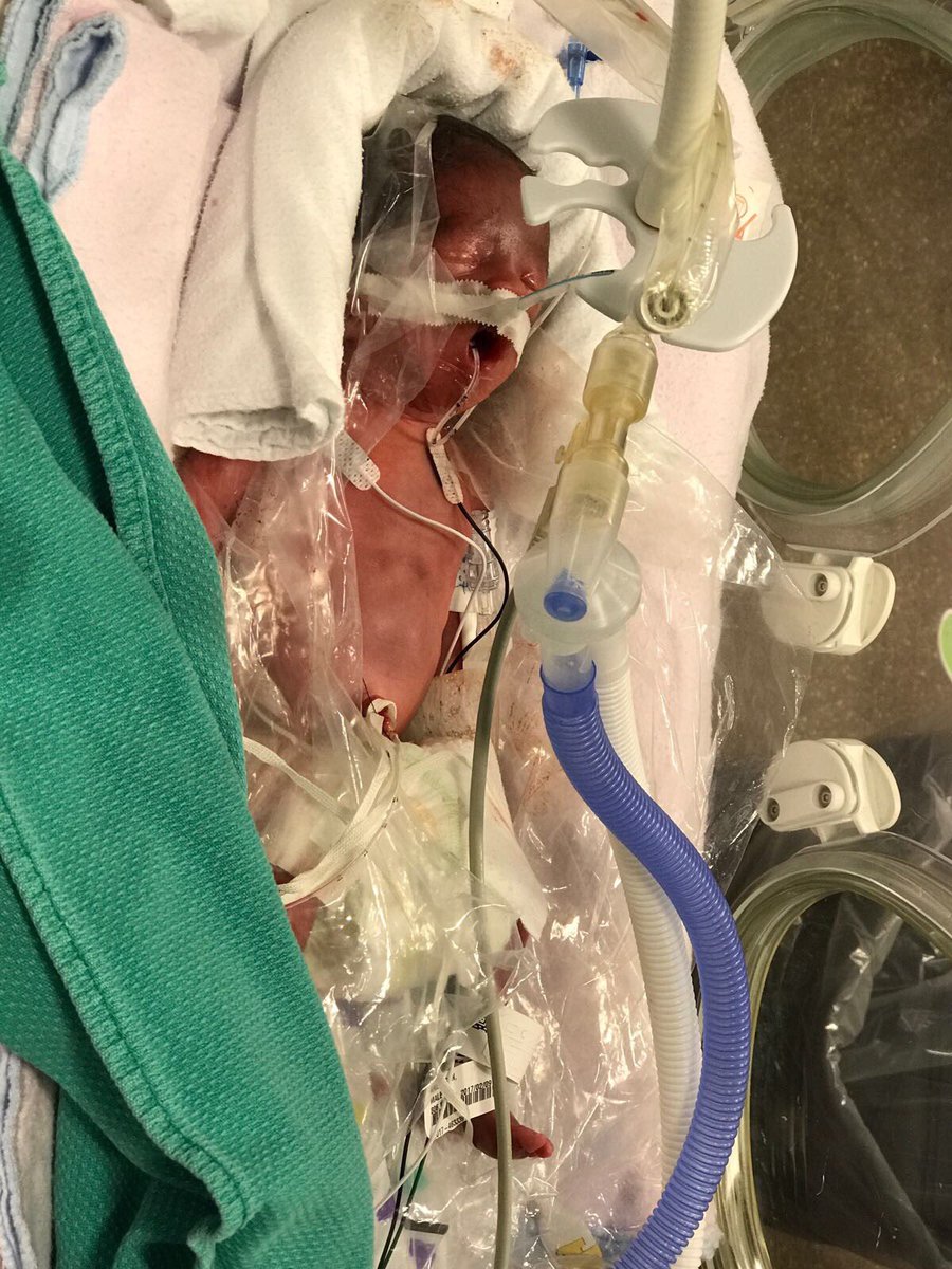 JamcanVacations's tweet photo. Support the families with Preemie who are currently at the #nicu #vjh Victoria Jubilee Hospital, #kingston #jamaica #jamcan #projectmiracle Like is at https://t.co/MeZLsvr7gu https://t.co/1BabhN4jzG