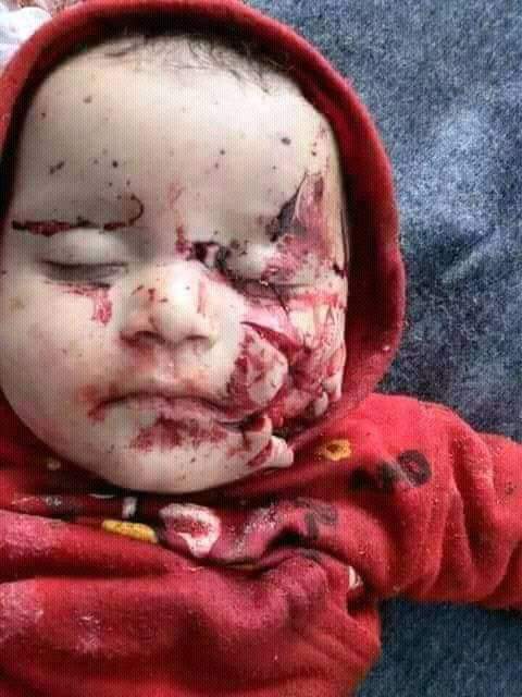 iamadlll's tweet photo. These are the flowers of the deatroyed garden of #Syria.They are eradiated before their blomming.
we the muslims still becomming the spectators and close our eyes on bloodshed of muslims of syria.
#میڈیا_کی_خاموشی_مجرمانہ_ہے
#SaveGhouta
#GhoutaGenocide
#LetsUniteToSaveMuslims https://t.co/ORibP0k9Pa