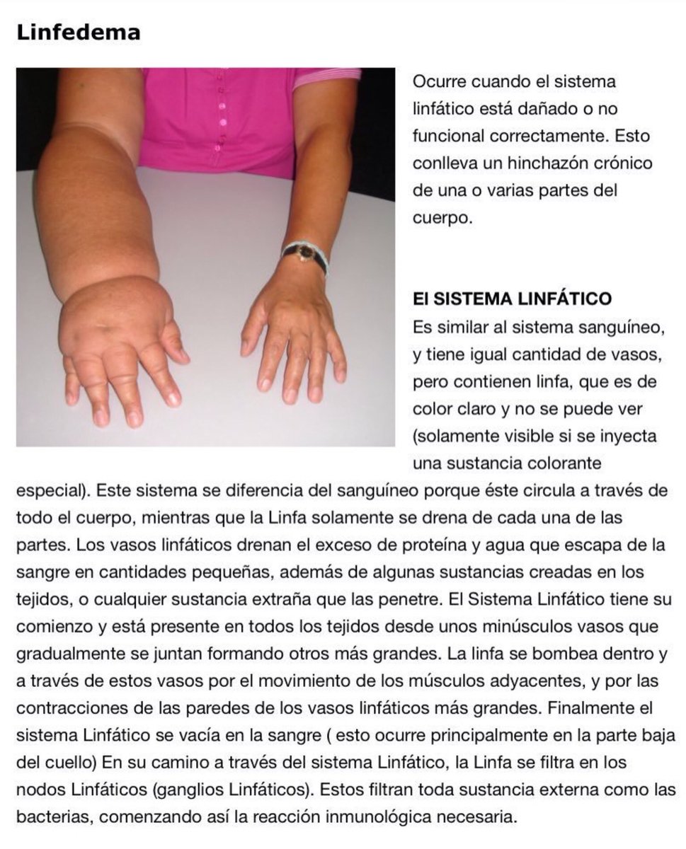 NoInvisibles's tweet photo. 6 de Marzo Día Int. #Linfedema #Lipedema
Conocer para prevenir
Investigar para curar
La secuela del #cáncer…
de la que hay q ocuparse!
https://t.co/fjHEJNAO32
En @elconfidencial
Infgr. @micofvlc @AMIIFMx https://t.co/EDmhXLntXQ
