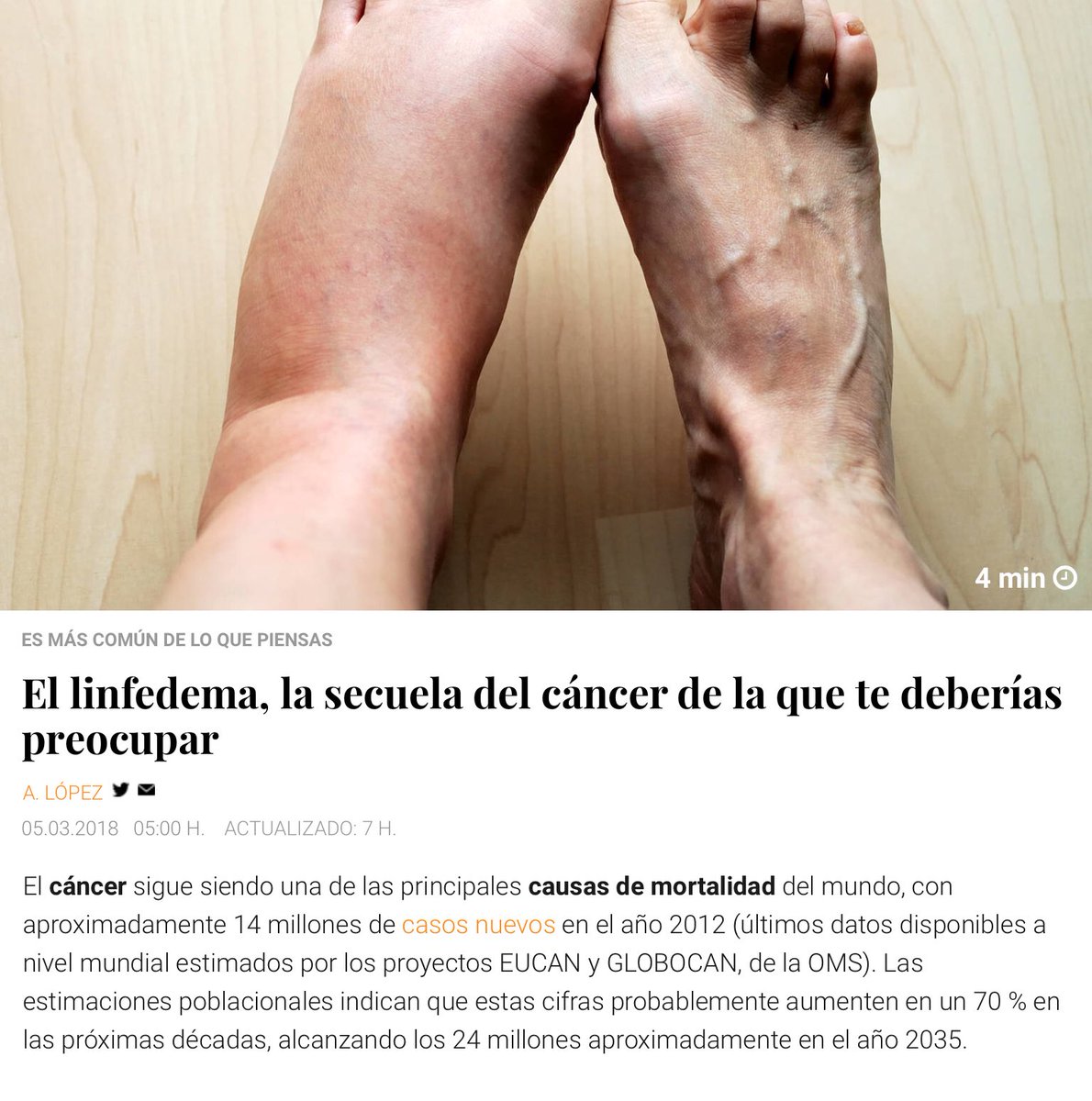NoInvisibles's tweet photo. 6 de Marzo Día Int. #Linfedema #Lipedema
Conocer para prevenir
Investigar para curar
La secuela del #cáncer…
de la que hay q ocuparse!
https://t.co/fjHEJNAO32
En @elconfidencial
Infgr. @micofvlc @AMIIFMx https://t.co/EDmhXLntXQ