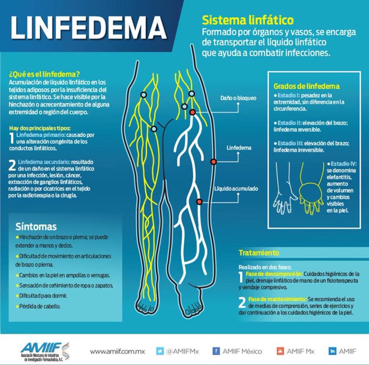 NoInvisibles's tweet photo. 6 de Marzo Día Int. #Linfedema #Lipedema
Conocer para prevenir
Investigar para curar
La secuela del #cáncer…
de la que hay q ocuparse!
https://t.co/fjHEJNAO32
En @elconfidencial
Infgr. @micofvlc @AMIIFMx https://t.co/EDmhXLntXQ