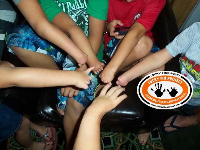form5prosthetic's tweet photo. .@luckyfinproject is a huge resource in #LimbDifferenceCommunity - making a huge impact by raising awareness for those with congenital or other limb differences!
#LuckyFinProject #LimbDifference #LuckyFin #JustKeepSwimming https://t.co/wkBzjEhfbH