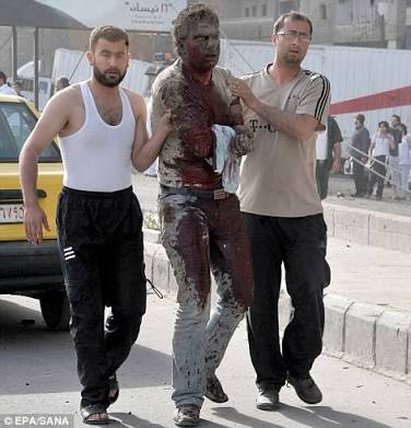 AMuswan's tweet photo. #letsUniteToSaveSyria
When will muslims wake
When will the UNO wake https://t.co/MCms9Quok2
