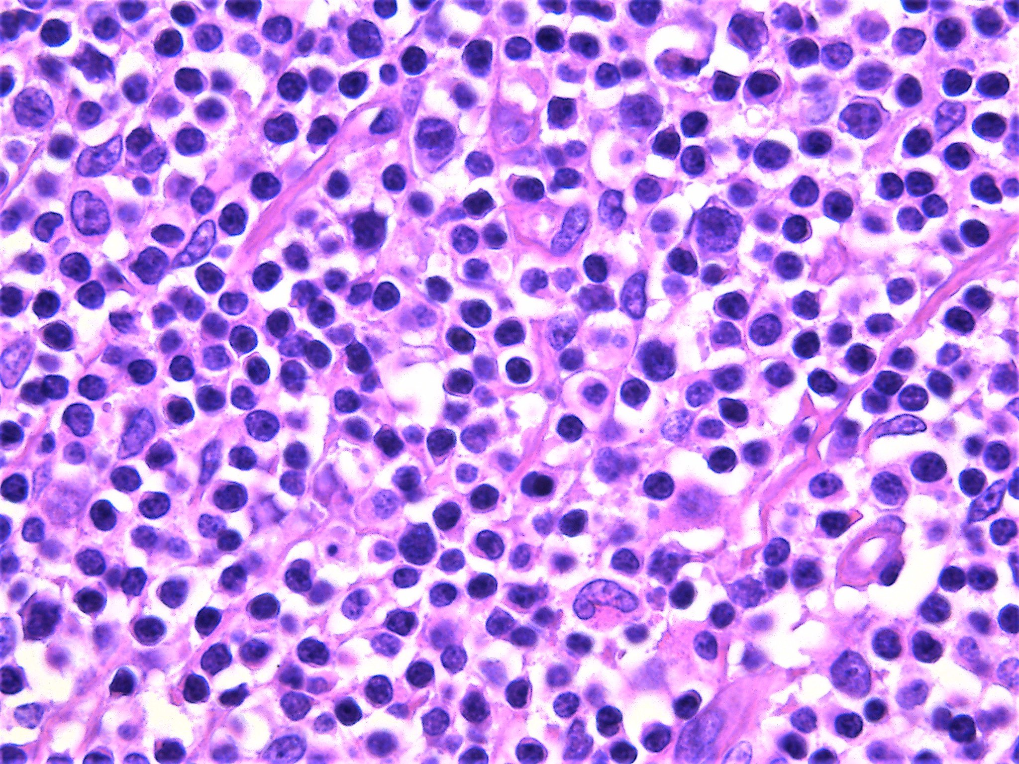 Pathology WalkerAuto Tweet Bot on Twitter "Monocytoid B