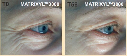 illumalift's tweet photo. Day 1 & Day 56...no words needed to describe why you absolutely need illumalift in your beauty routine & anti-aging defence! Illumalift contains the required amount of #Matrixyl3000 in our formulation to achieve these results. #nobs #antiaging #vegan #crueltyfree #wearindiebeauty https://t.co/pSyThjgHpl