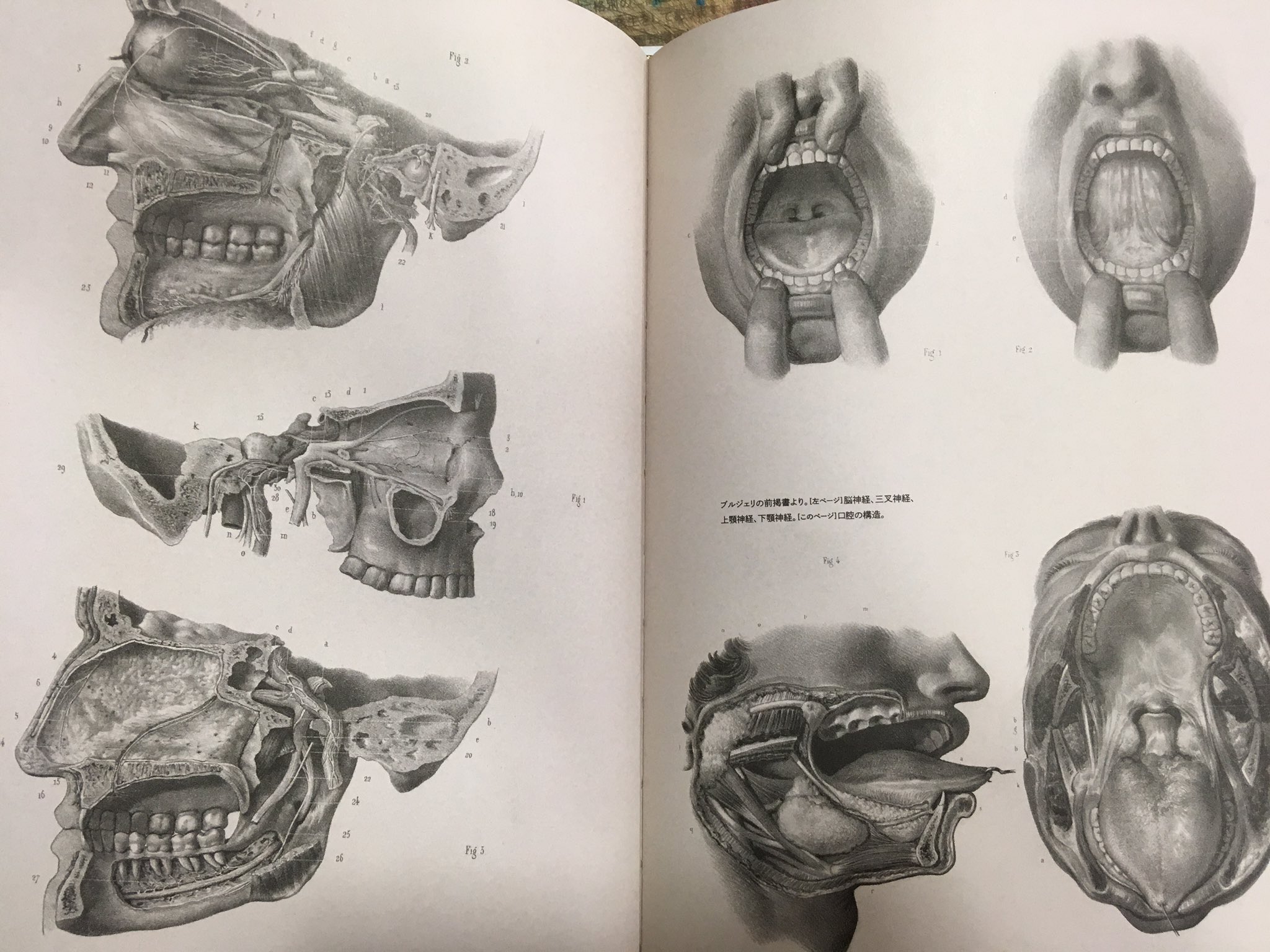 医学書）描かれた歯痛、描かれた病、描かれた手術の３冊（河出書房新社） 医学書）描かれた歯痛、描かれた病、描かれた手術の3冊