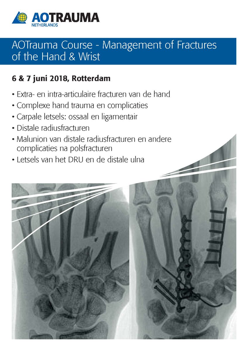 Graag willen wij u er op attenderen dat wij dit jaar de AOTrauma Course—Management of Fractures of the Hand &amp; Wrist organiseren op 6 &amp; 7 juni in Rotterdam. 
U kunt zich inschrijven via bit.ly/2yPRLzY