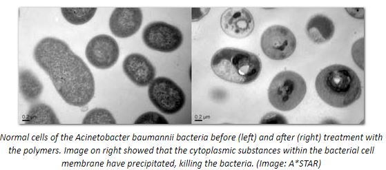 NCCOIN1's tweet photo. New synthetic molecule can kill five types of deadly drug-resistant superbugs
https://t.co/pcWQAKDgBA? https://t.co/fpBXIPMT48