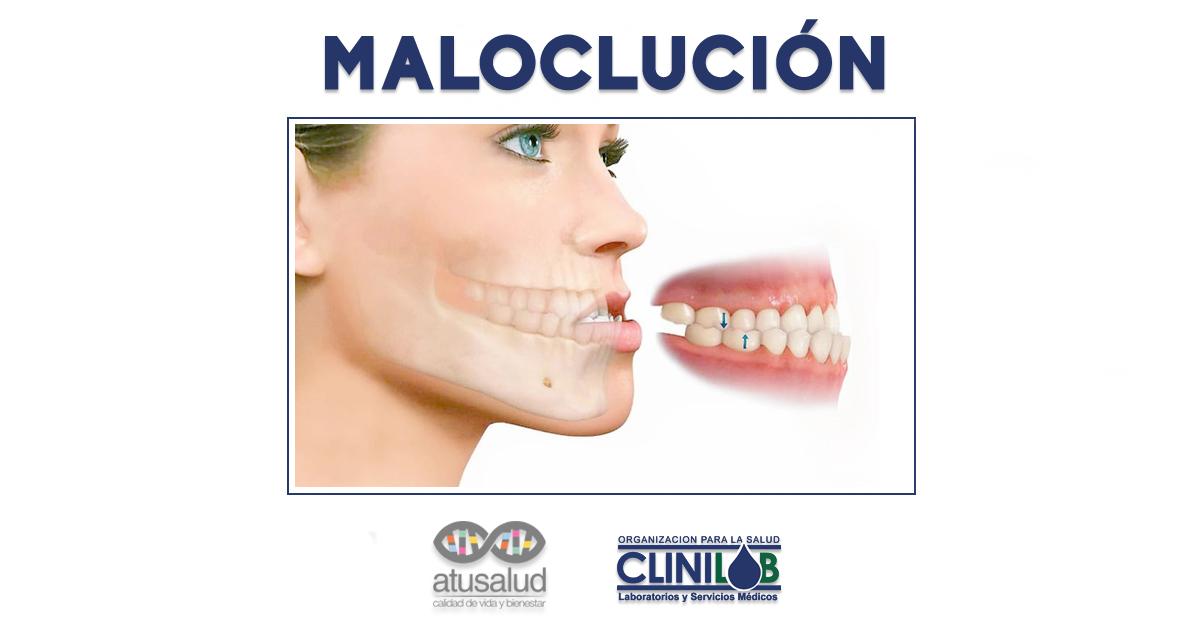 atusaludenlinea's tweet photo. Sucede cuando la mordida no está correctamente alineada, una afección muy común que puede requerir de ortodoncia. Consulte al #Odontólogo → @Clinilabve #6Mar #Clinilab https://t.co/GE26j5xFOG