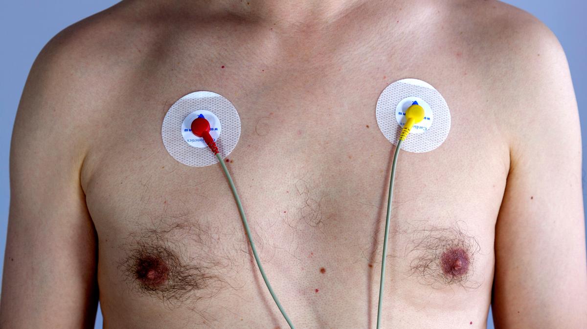 VICEUK's tweet image. Why You Might Suddenly Die in Your Twenties dlvr.it/QJxZTG