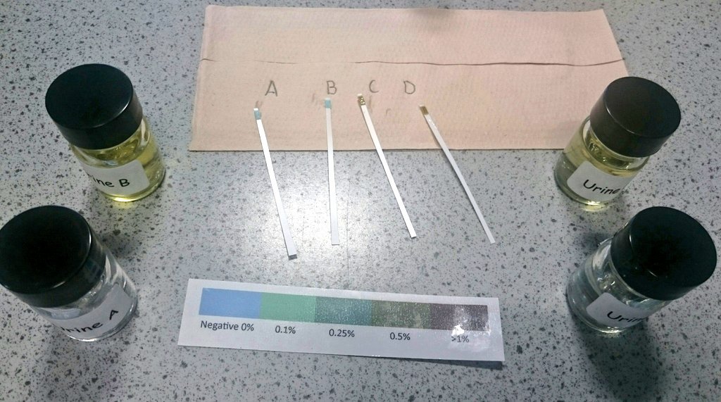 Miss_I_Iqbal's tweet photo. S3 Biologists were testing for glucose in order to diagnose #diabetes 🔎🔬📝#BiologyInvestigation #urinesamples #realorfake 🤔 @DiabetesUK @NHS_Education https://t.co/zEQjelOAs5