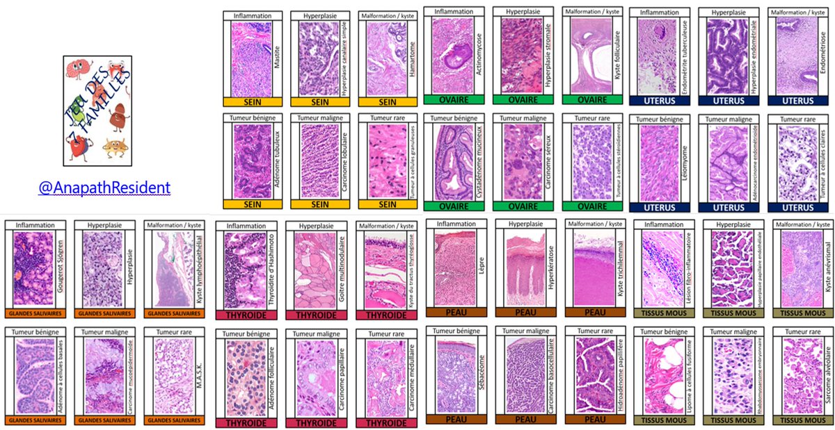 A_Morini_MD's tweet photo. Special Tweet : Learning while having fun with surgical pathology !!
- "Jeu de l'oie"
- Happy Famillies
- Where's Waldo (Charlie in French)
#PathGames, #PathChallenge, #passagoodday https://t.co/q7DzpGPTCC