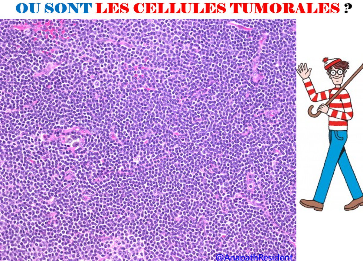 A_Morini_MD's tweet photo. Special Tweet : Learning while having fun with surgical pathology !!
- "Jeu de l'oie"
- Happy Famillies
- Where's Waldo (Charlie in French)
#PathGames, #PathChallenge, #passagoodday https://t.co/q7DzpGPTCC