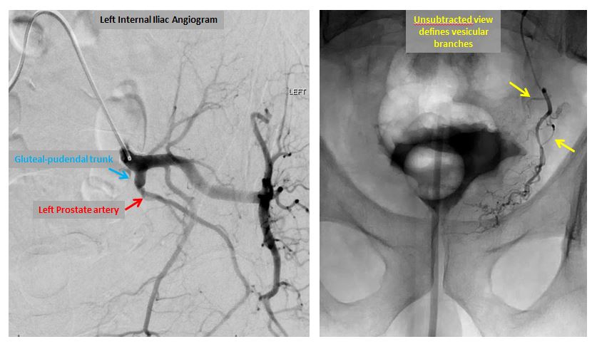 Albany IR tweet media
