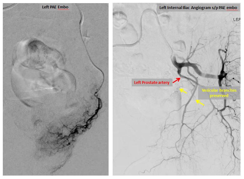 Albany IR tweet media