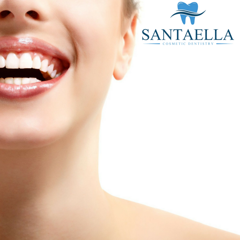 SantaellaPR's tweet photo. Watch your diet! Diet is important. Certain foods are damaging to the teeth.
-
https://t.co/hY9fqQ4POr

#dentist #aestheticdentistry #generaldentistry #dentistry #guaynabo #diet #watchyourdiet #food #teeth #damage #teethdamage #teethcare #oralcare #oral #oralcare #oralhealth https://t.co/hpdPRIm4cU