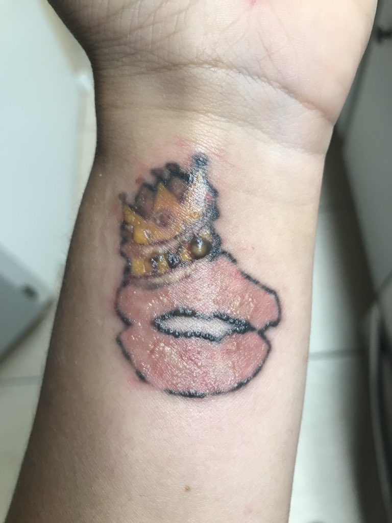 tayhefff's tweet photo. I just wanna post these here for future  reference lol
Before, imediately after, 11 hours later https://t.co/tupKLC9Cdb