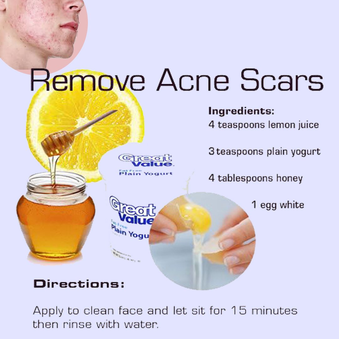 meherali553's tweet photo. #Health #fitness #skincare #healthyskin #removeacne #beauty #beautiful #beautycare https://t.co/ATrzi844XY