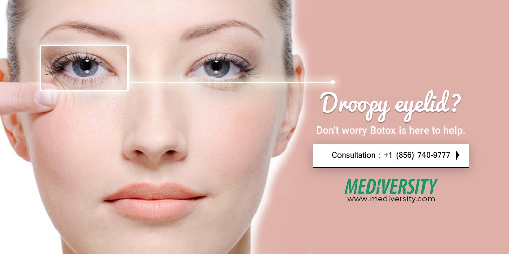 Mediversity's tweet image. Droopy Eyelid?
Don't worry Botox is here to help.
mediversity.com
#botox #botoxtreatment #weightloss #NewJersey