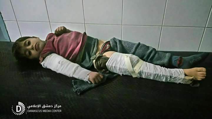 Itxcymera's tweet photo. Several casualties among civilians mostly children, aftermath airstrikes targeted #Saqeba town.

Eastern #Damascus countryside #Syria Mar 7
#میڈیا_کی_خاموشی_مجرمانہ_ہے
#SaveGouta
#StandUpPakistanForSyria https://t.co/3PGkLCSdUA