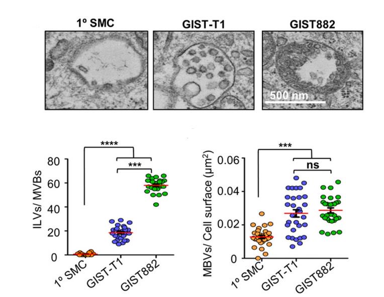 molcellprot's tweet photo. Insights into the proteome of gastrointestinal stromal tumor-derived exosomes reveals new potential diagnostic biomarkers. A March #ResearchHighlight from  @SafiAtay and colleagues. https://t.co/UwGKAdyxue https://t.co/SDsZ6vnPRB