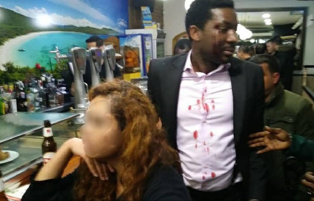 Actor Marius Makon was involved in a racist incident on Saturday, where a woman in a Madrid bar called him a “black piece of shit” and said “I’m white. I can kill you and nothing will happen,” all before assaulting him with a bottle:  buff.ly/2FnmZ1E