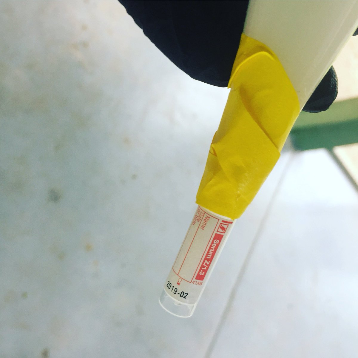 BatConservancy's tweet photo. It’s not all cute feedings and adorable bonding time in our line of work. Someone’s gotta collect the pee for analyzing! 😷
#workingWednesday #whatpeoplethinkido #whatiactuallydo #keeperlife https://t.co/wLWlLtOGe8